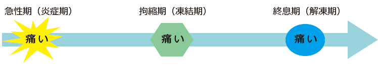 肩関節周囲炎