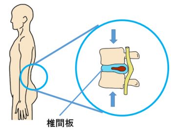 椎間板