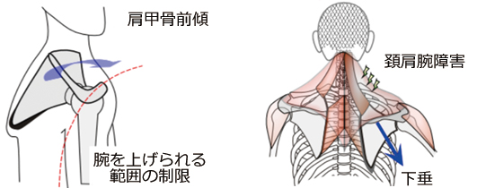 肩甲骨